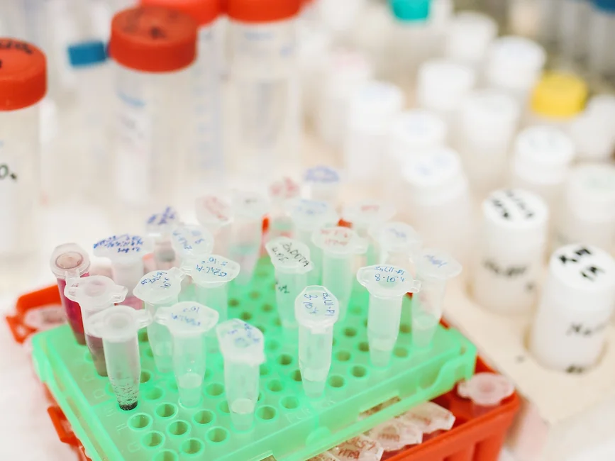 Tubos de muestra en un rack de laboratorio (imagen ilustrativa genérica, sin relación directa con el hecho). Banco: Pexels, foto de Polina Tankilevitch.